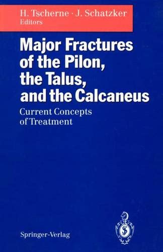 Major Fractures of the Pilon, the Talus, and the Calcaneus Current Concepts of Treatment Doc